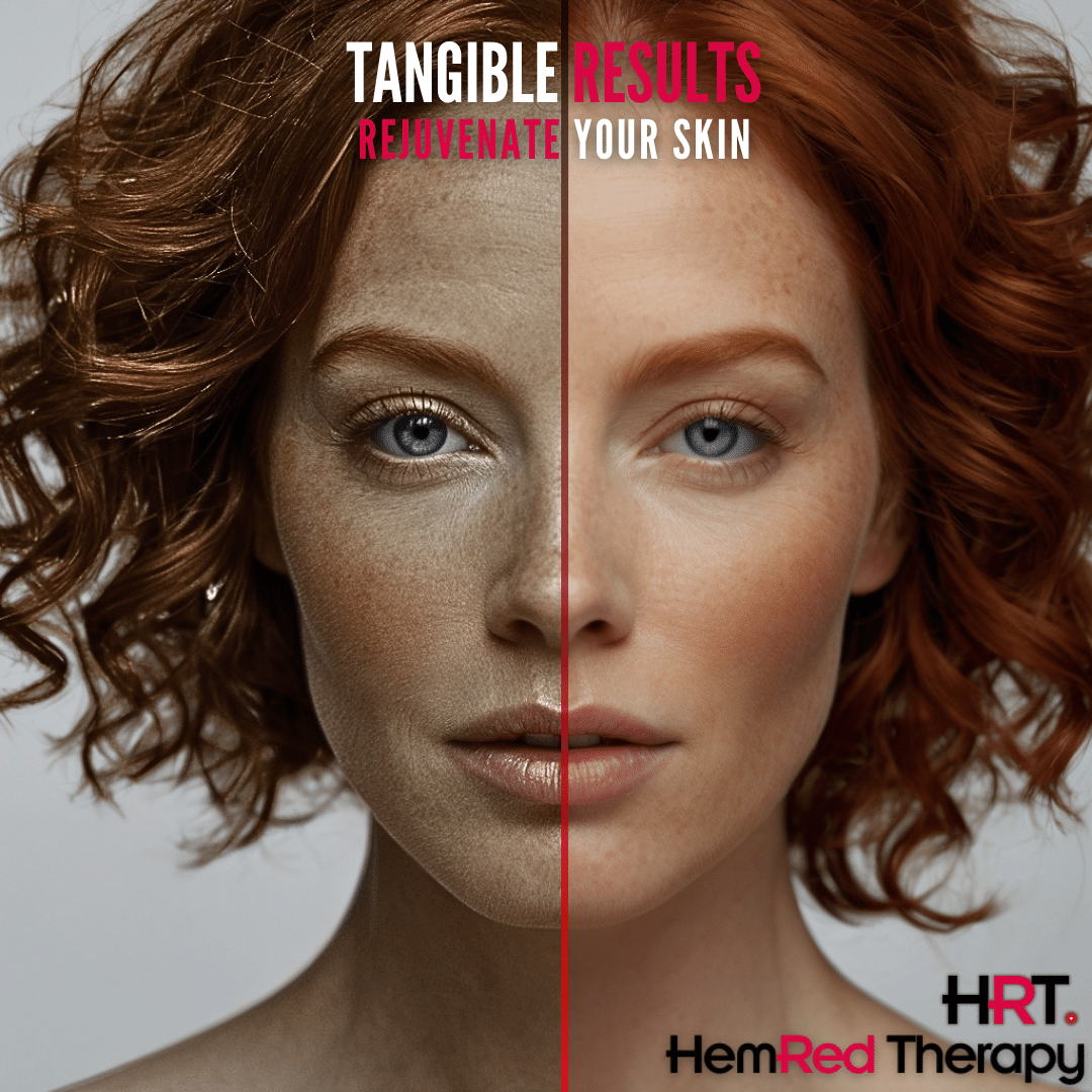 HemRed Therapy PureLight 225 skin routine visual