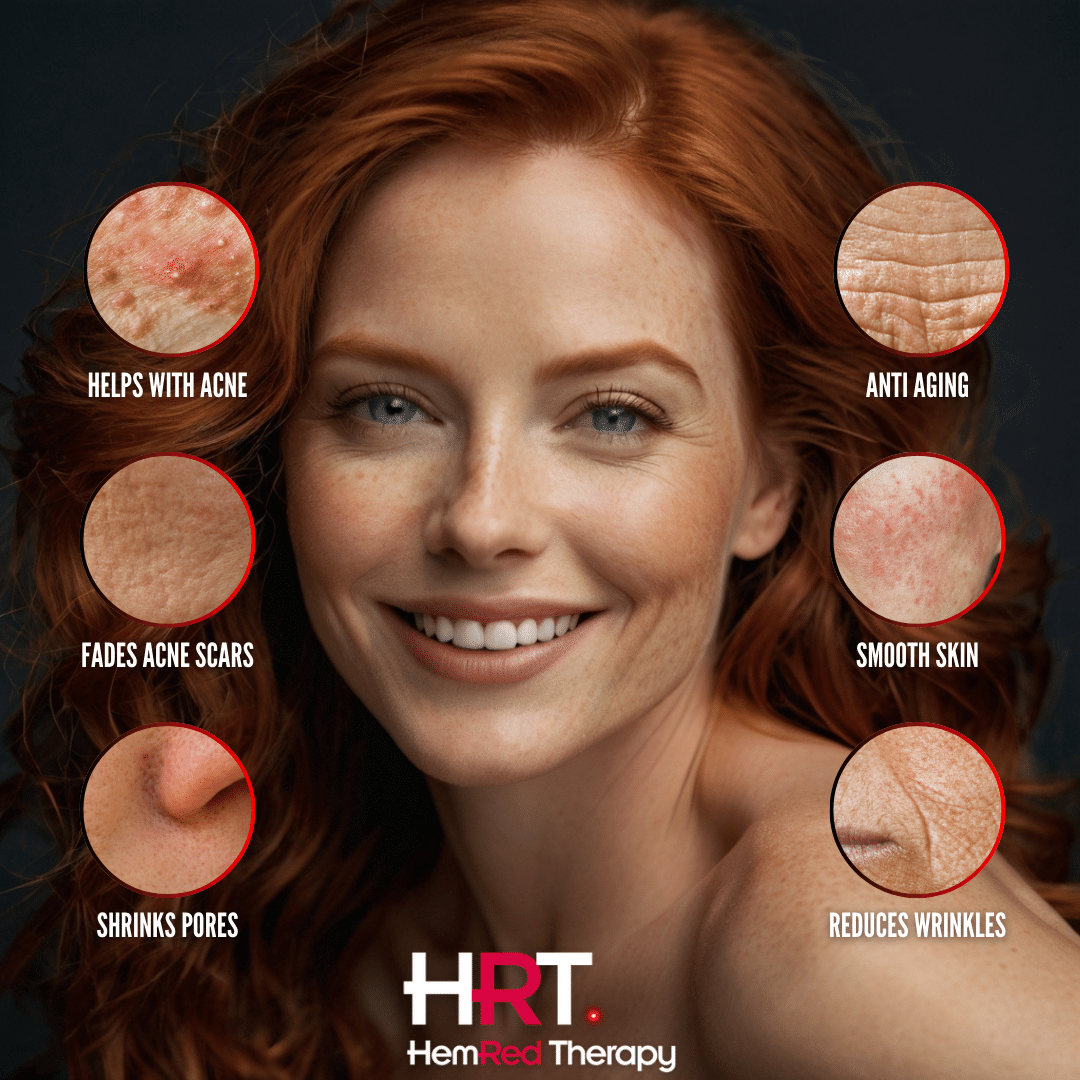 HemRed Therapy PureLight 225 skin benefits visual for acne, wrinkles, pores, and anti-aging
